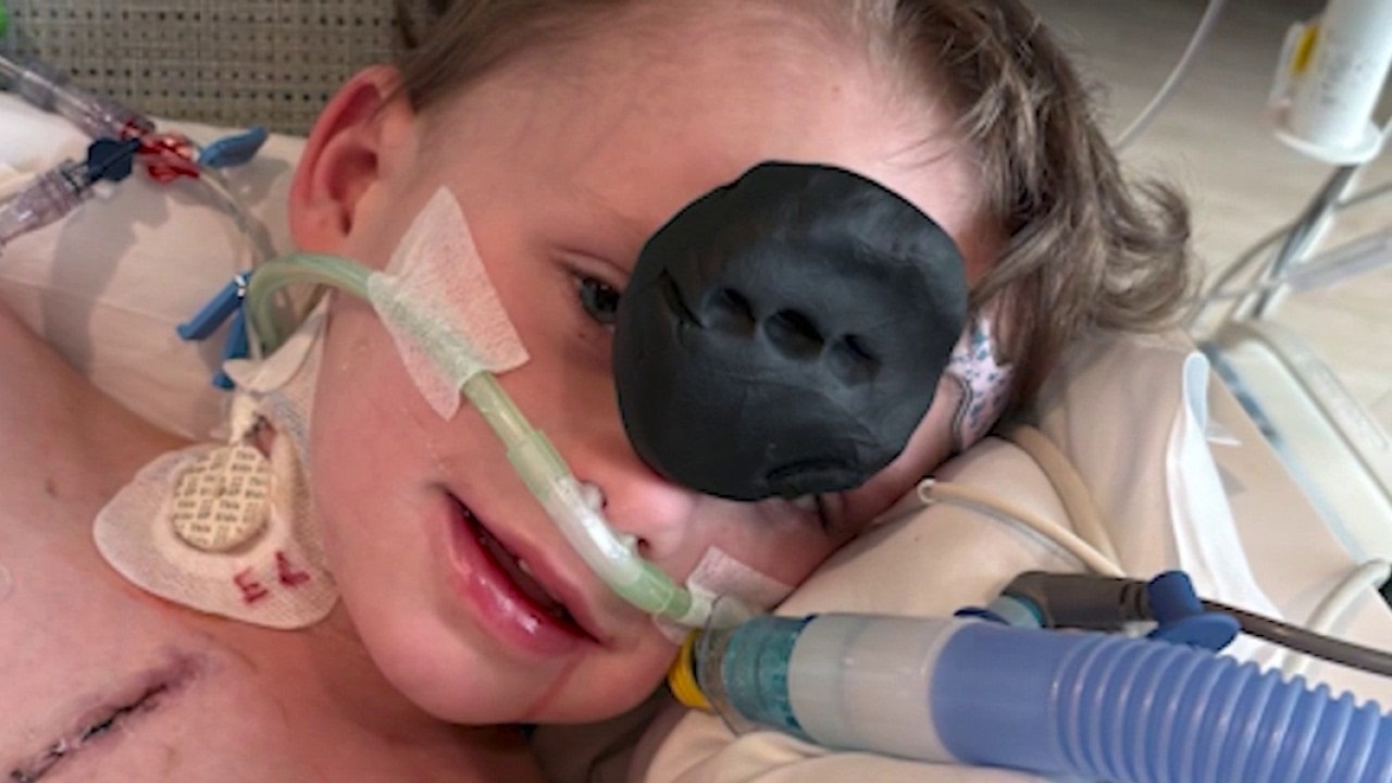 5-year-old Dalton boy faces life support after surgery