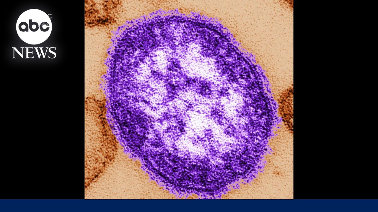 2 people die from measles in Pennsylvania, marking state’s first deaths in 35 years