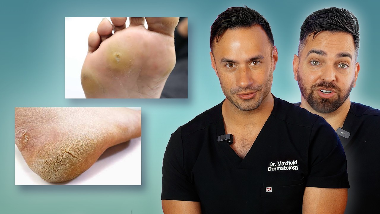 The ULTIMATE Guide to Foot Care | Cracked Heels, Fungus, Corns, Warts & More