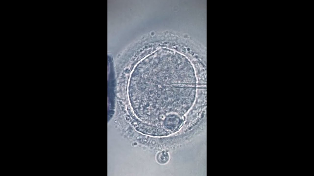 Florida couple sues after IVF mix-up