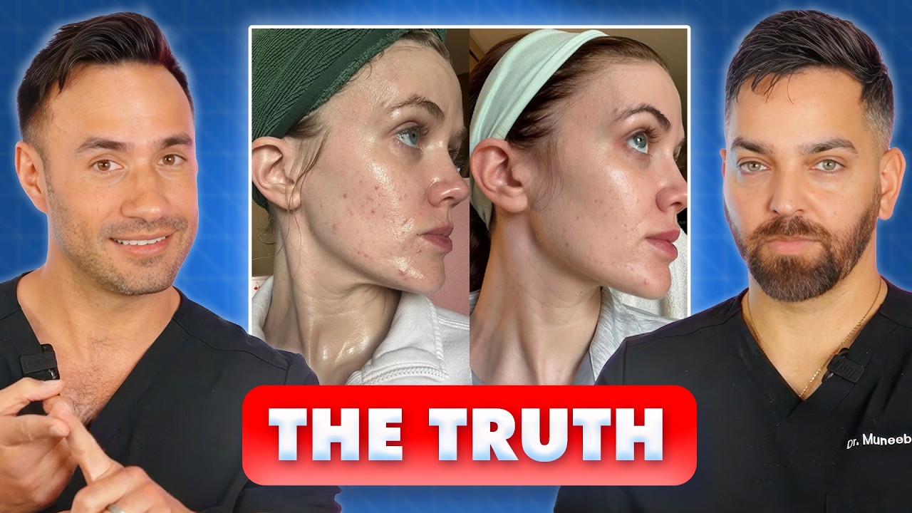 GLASS SKIN? Tretinoin & Azelaic Acid Viral Routine Debunked