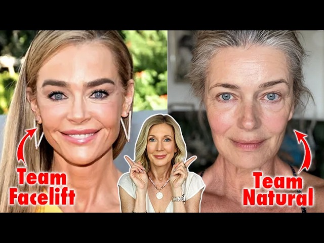 Move Over “Aging Gracefully” The Rise of . . . Facelifts?