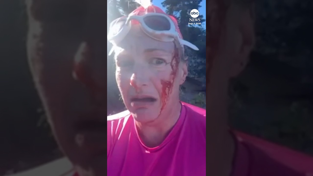 Woman needs 38 stitches after otter attack
