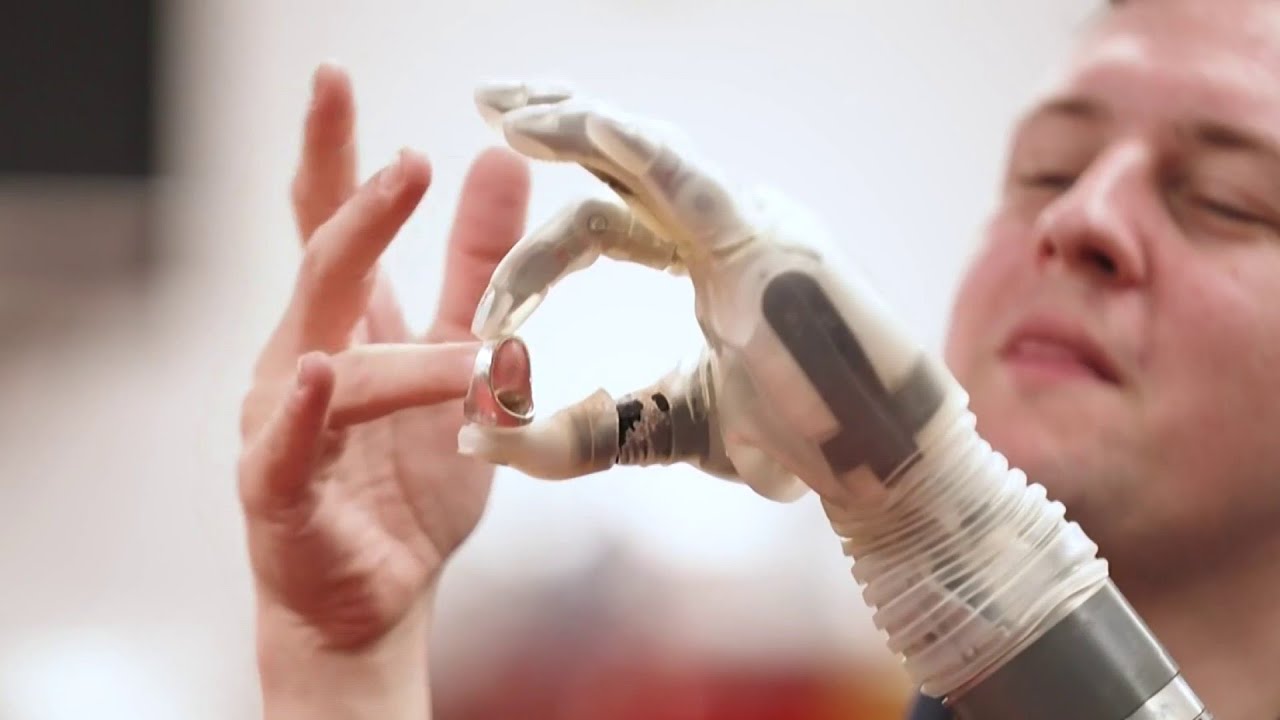 An AI-powered chip allows an amputee to control his robot prosthetic with his mind