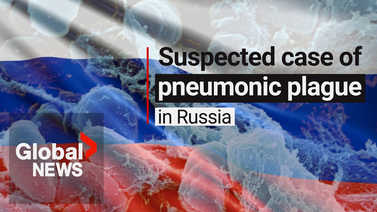 Russian plague: What we know about suspected case linked to lab worker’s death